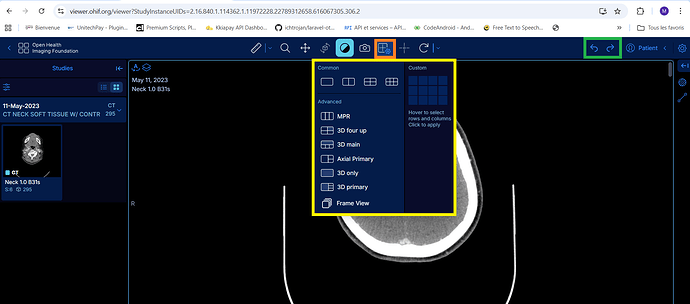 Zoom - Pan - 3D Rotate - Window Level - Capture - Change layout (tool-layout) - Crosshairs - etc